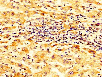 SCNN1B Antibody