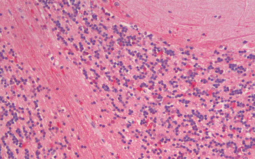 ZNRF1 (mouse) Antibody