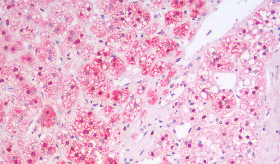 MSI2/musashi-2 (aa33-43) Antibody