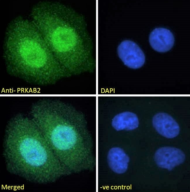PRKAB2 Antibody