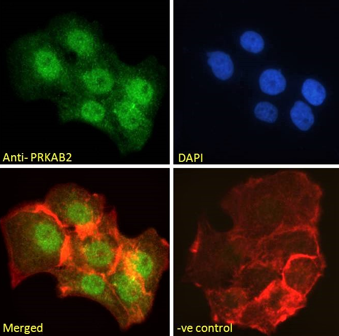 PRKAB2 Antibody