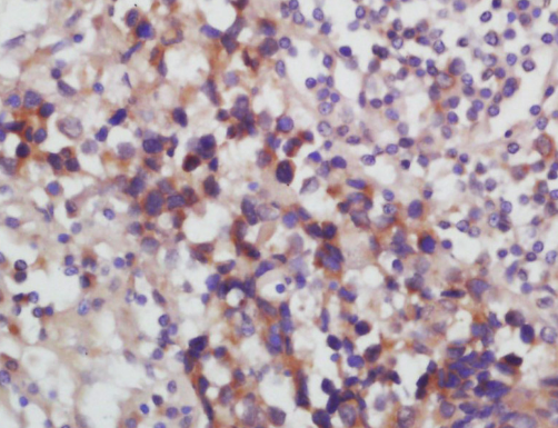 Desmoglein 2 Rabbit Polyclonal Antibody (FITC)