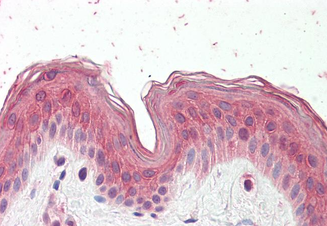 CYP24A1 Antibody