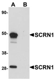 SCRN1 Antibody