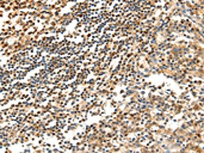 SCTR Antibody
