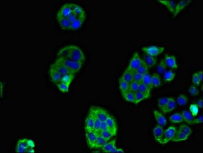 SCTR Antibody