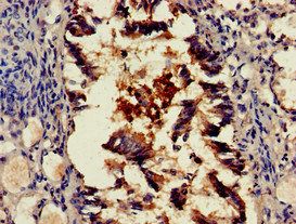 SCTR Antibody