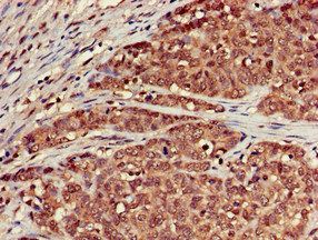 SCTR Antibody