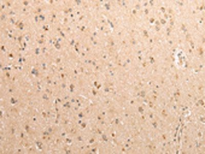 SDCBP Antibody