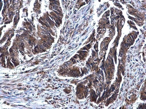 SDHB antibody [C2C3], C-term