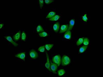 SEC14L2 Antibody