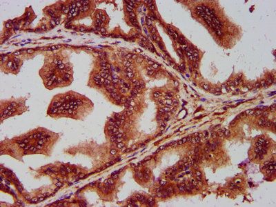 SEC14L2 Antibody