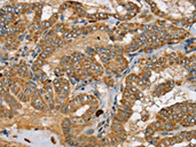 SEC14L2 Antibody