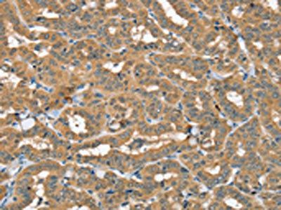 SEC14L2 Antibody