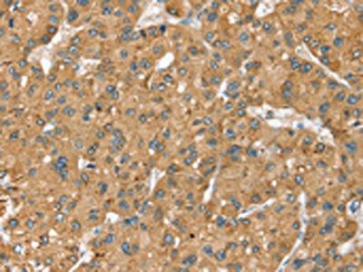 SEC14L2 Antibody