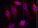SEK1/MKK4 (Phospho-Ser80) Antibody