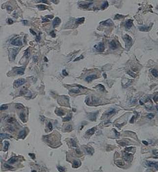 Selectin E Rabbit Polyclonal Antibody