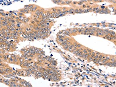 SEMA3G Antibody