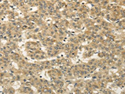 SEMA4F Antibody