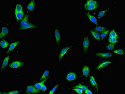SENP1 Antibody