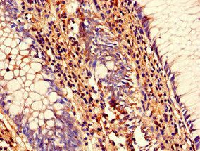 SENP1 Antibody