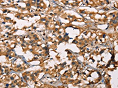 SENP1 Antibody