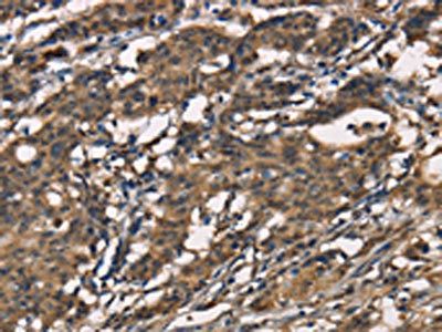 SENP1 Antibody