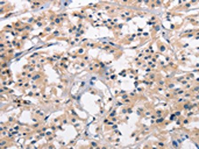 SENP1 Antibody