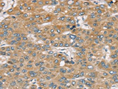 SENP1 Antibody