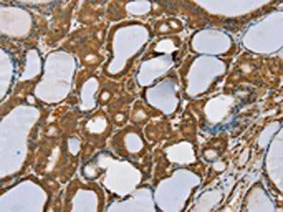 SENP1 Antibody