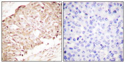 SENP1 Antibody