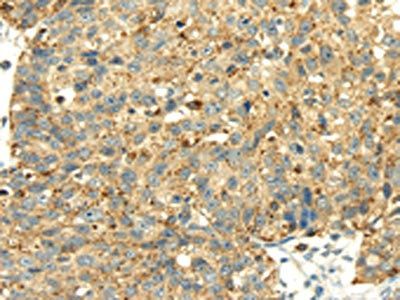 SENP2 Antibody