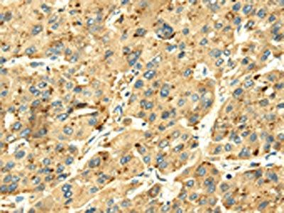 SENP2 Antibody