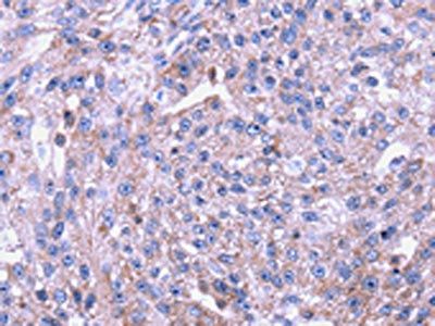 SENP2 Antibody