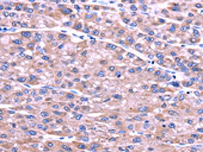 SENP2 Antibody