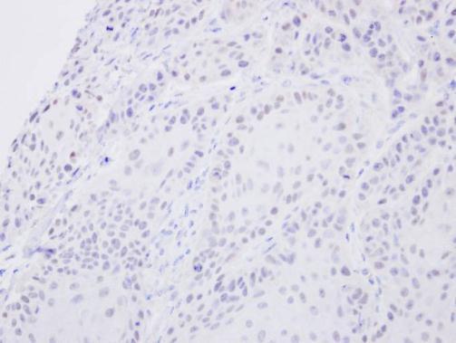 SENP2 antibody [N1], N-term