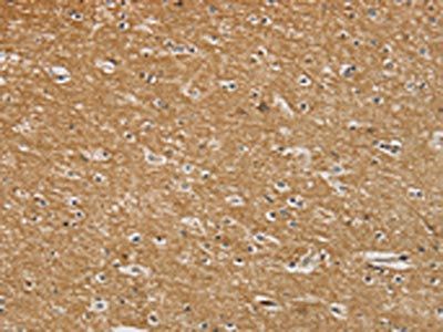 SENP3 Antibody