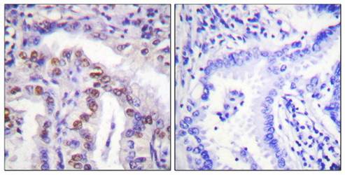 SENP6 Antibody
