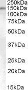 SENP6/SUSP1 Antibody