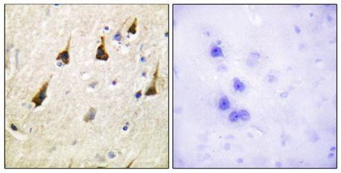 SENP7 Antibody