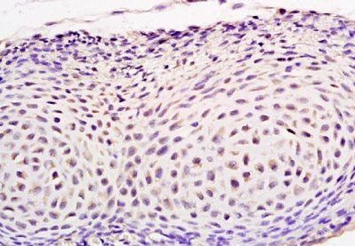 SEPT1 Rabbit Polyclonal Antibody
