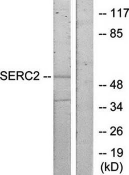 SERINC2 Antibody