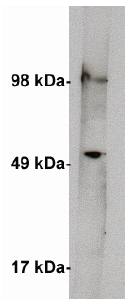 Rabbit anti Human Serine Palmitoyltransferase 1