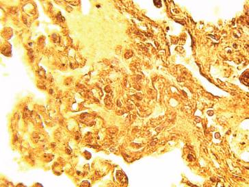 Rabbit anti Human Serine Palmitoyltransferase 1