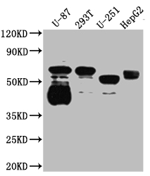 SLC6A4 Recombinant Monoclonal Antibody