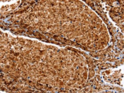 SERPINA3 Antibody