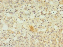 SERPINB8 Antibody