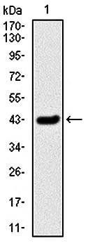 SERPINE1