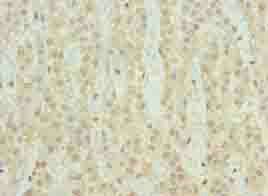 SERTAD1 Antibody