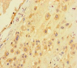 SARS Antibody